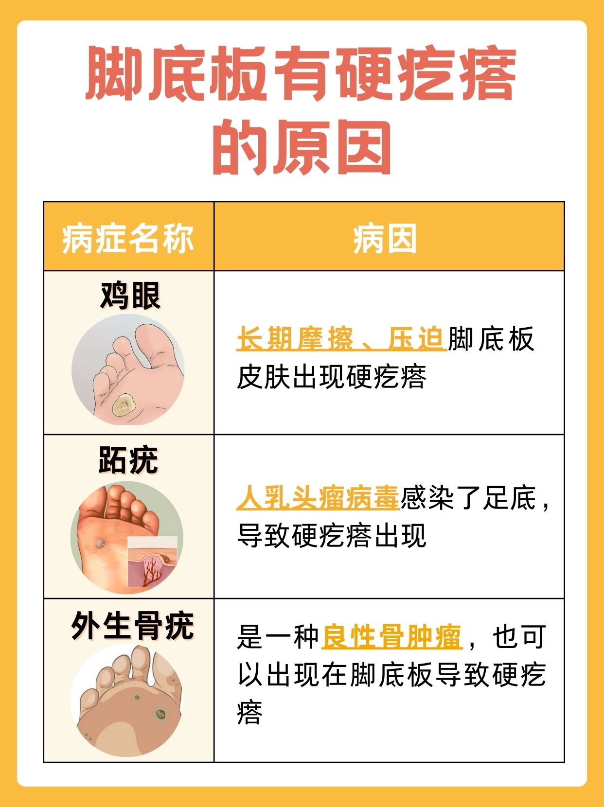 脚底板有硬硬的小疙瘩，医生说出原因！