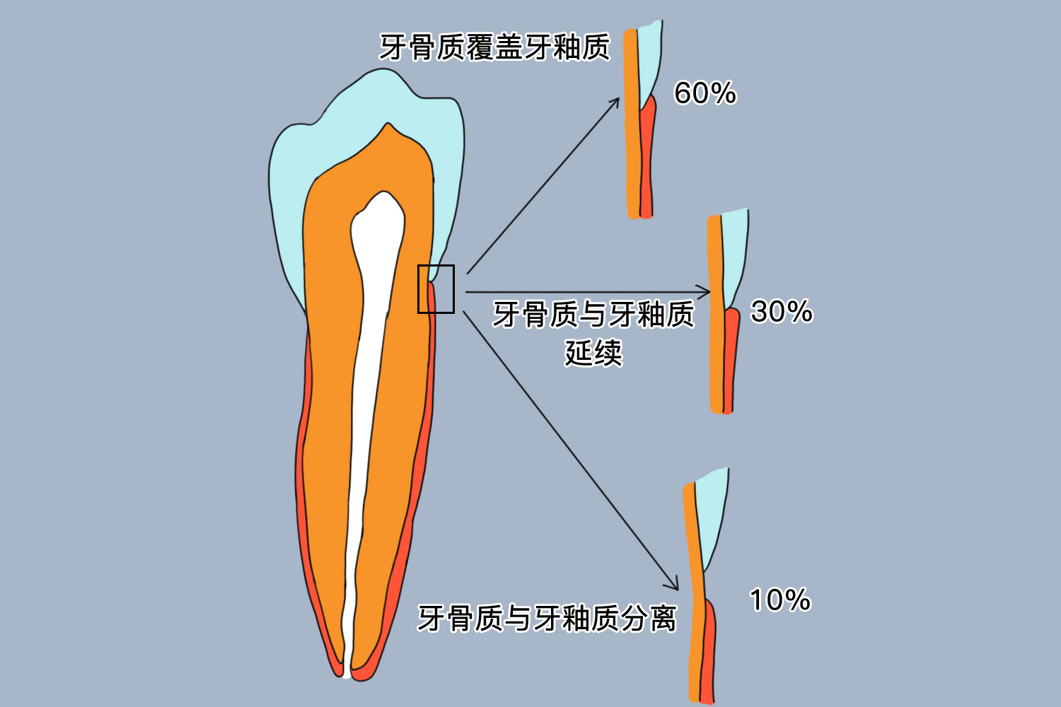 釉牙骨质界位置图
