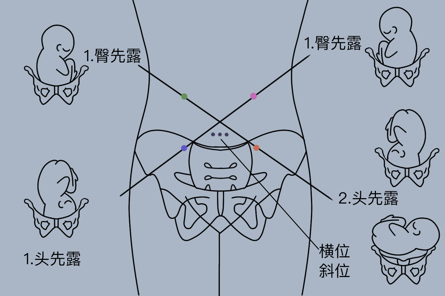 听胎心音的四个位置图片