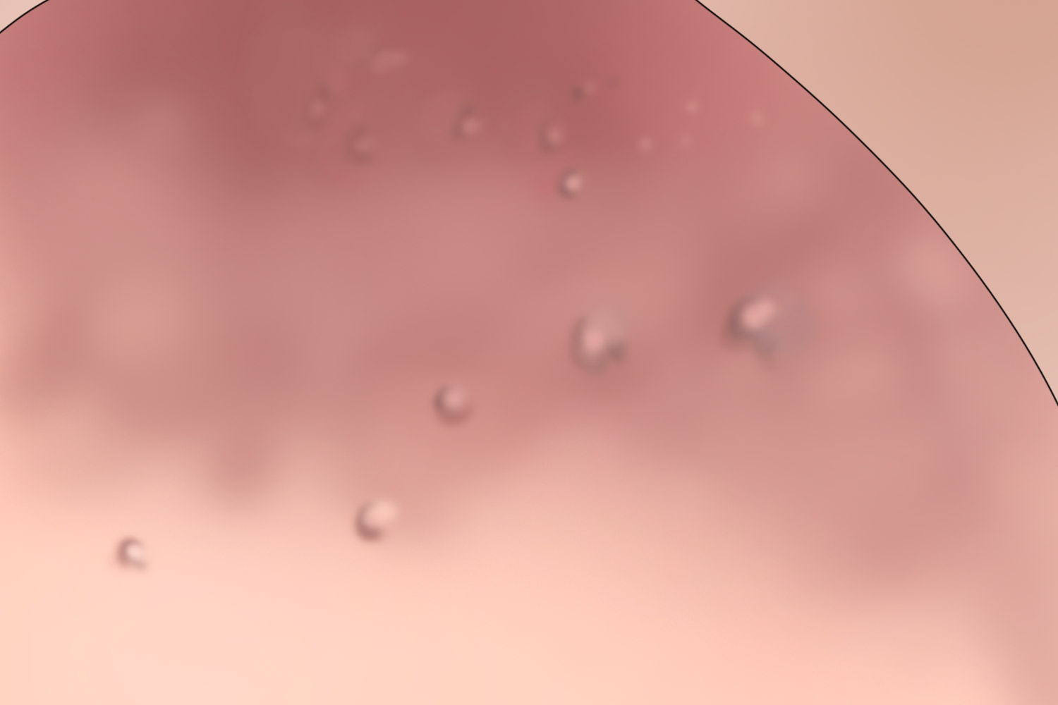 乳晕蒙氏结节图