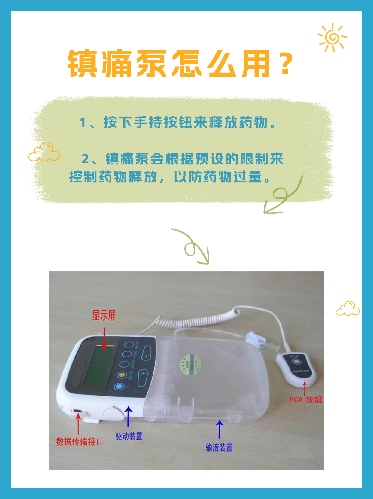 亲身经历：镇痛泵怎么用？看完就懂了！