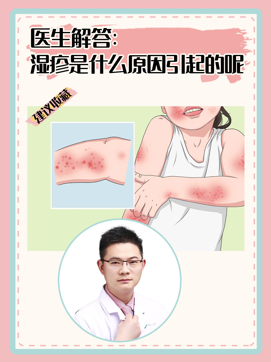 医生解答：湿疹是什么原因引起的呢