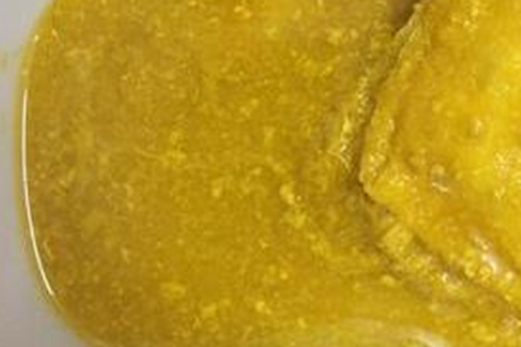 消化不良大便图