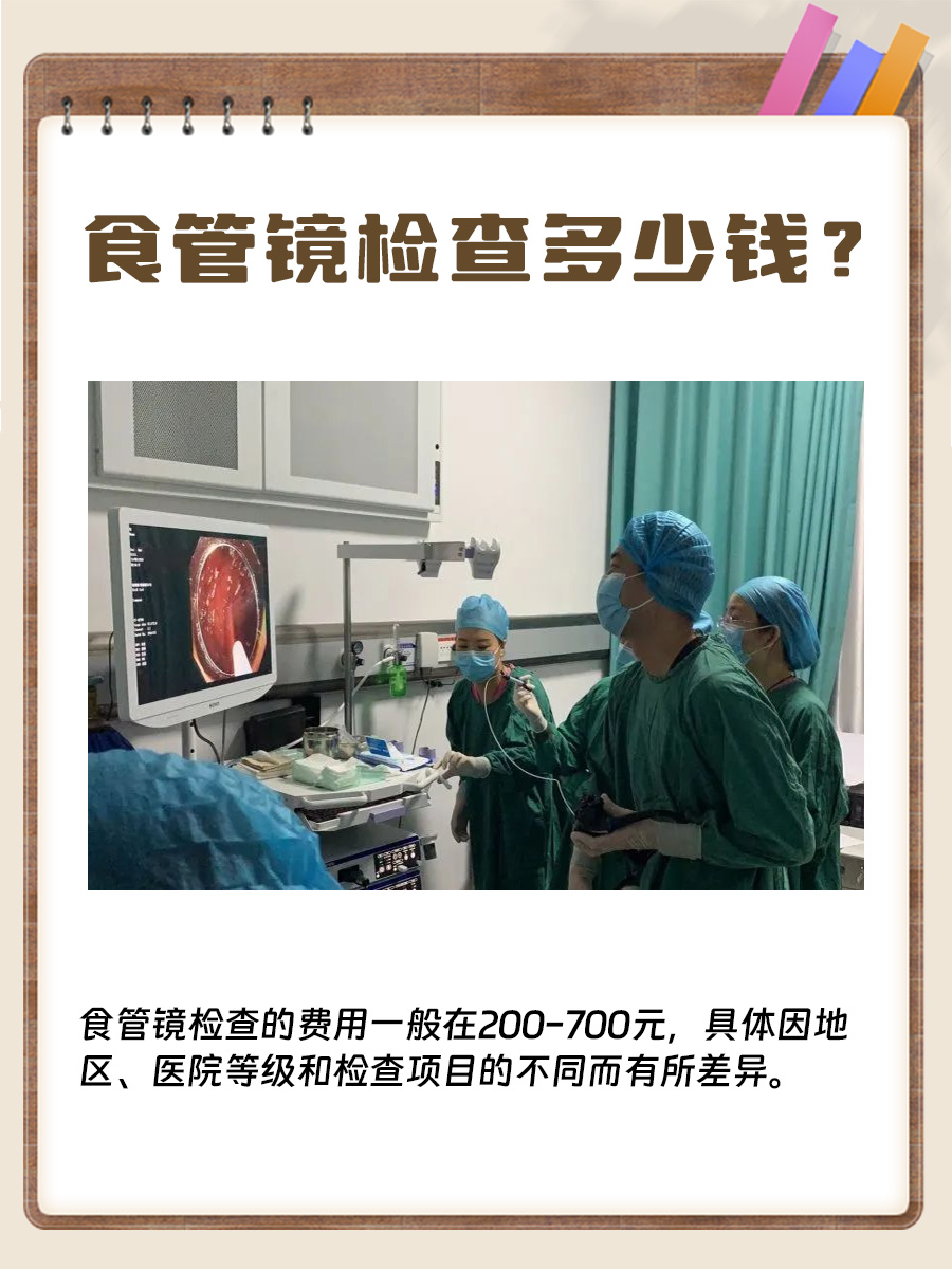 食管镜检查费用全解析，了解不花冤枉钱