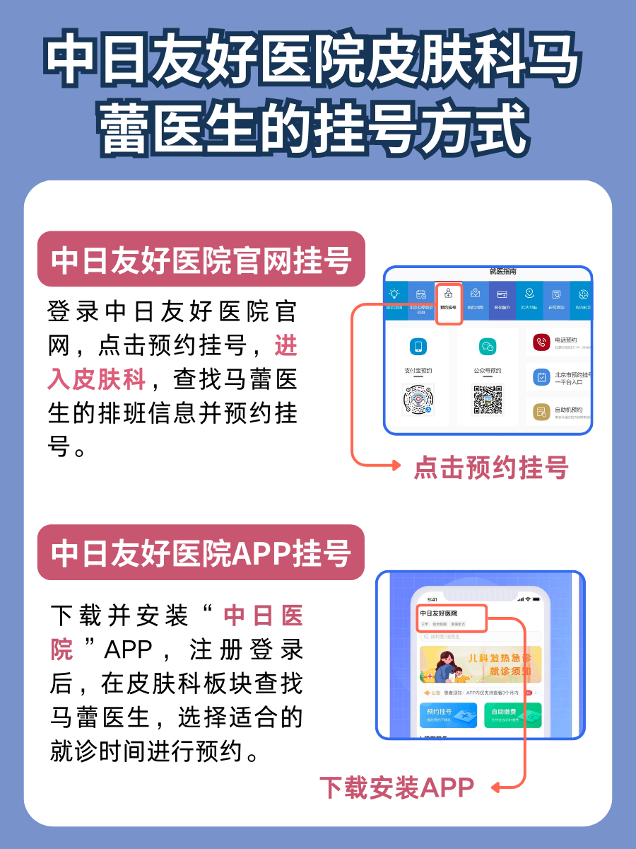 中日友好医院马蕾医生怎么样?怎么挂号?