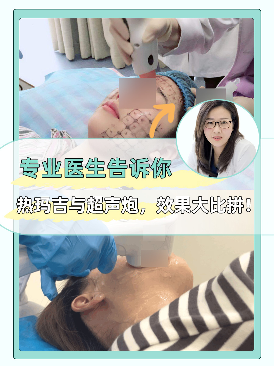 专业医生告诉你:热玛吉与超声炮,效果大比拼!