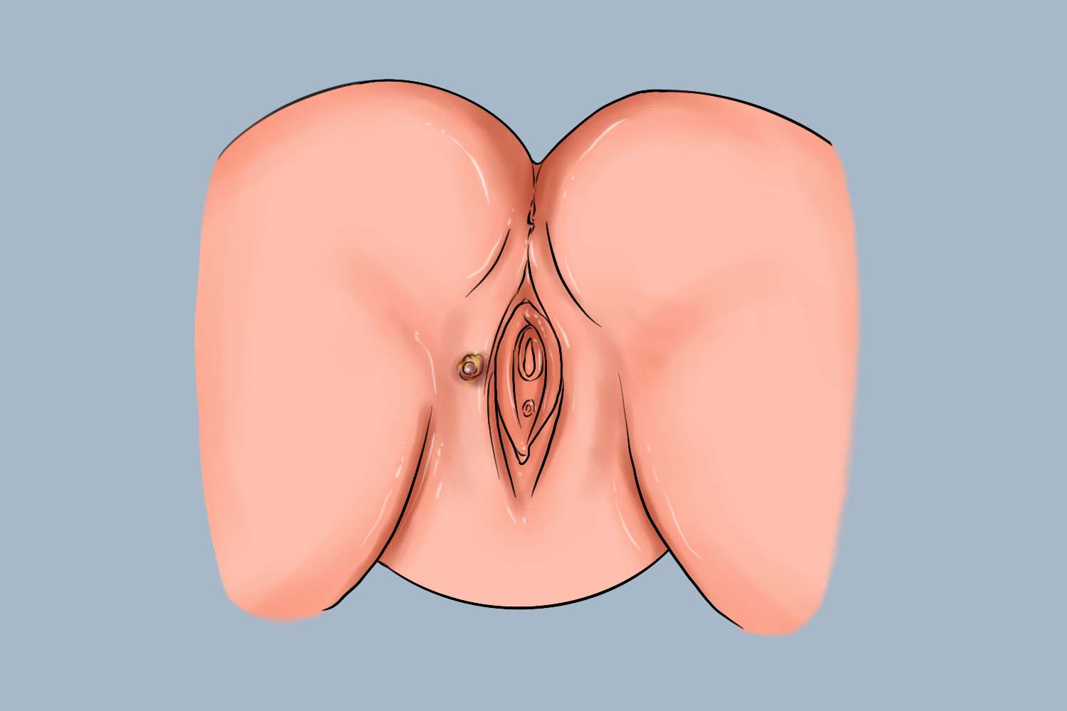 慢性外阴溃疡症状图