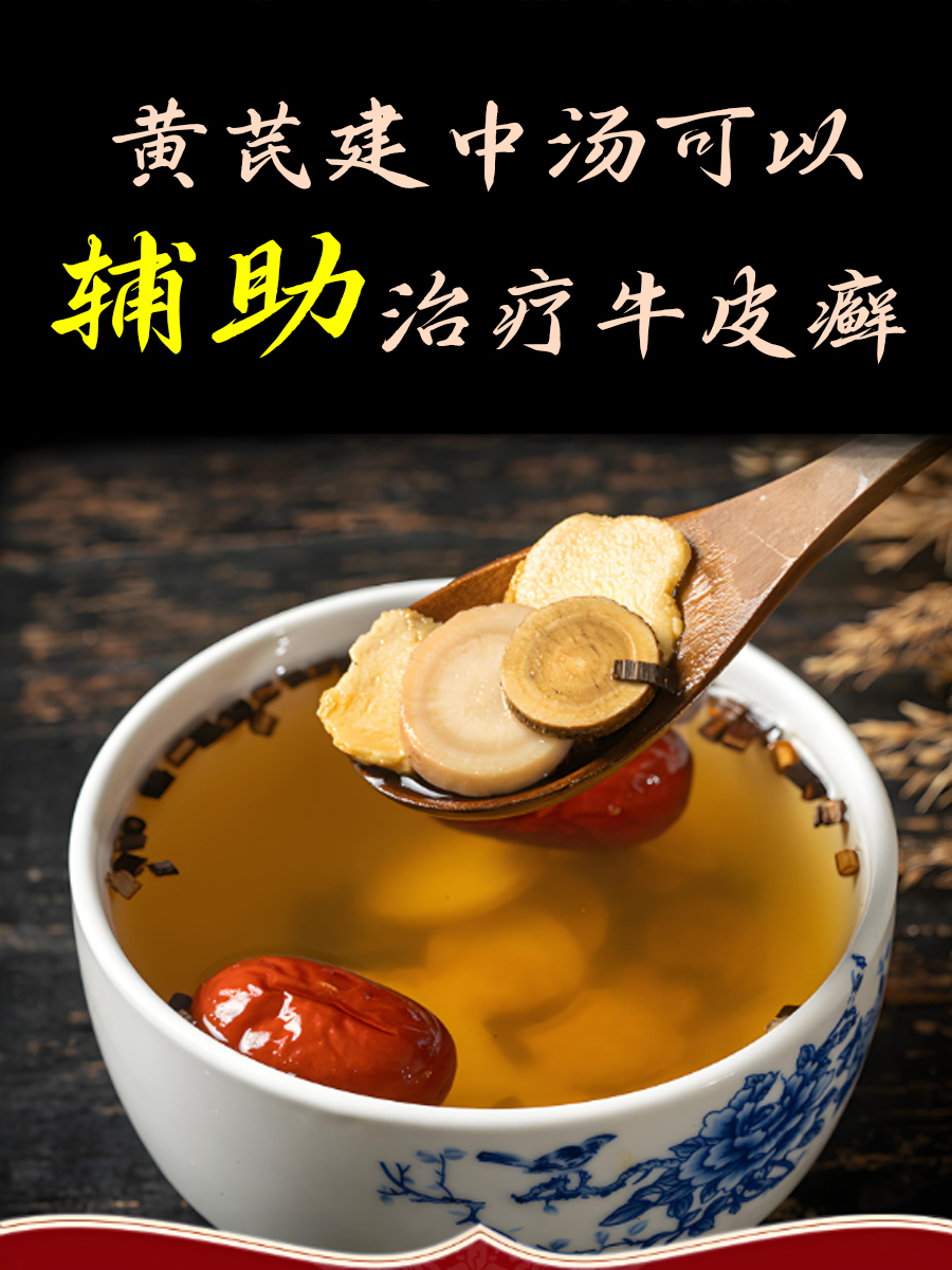 黄芪建中汤治疗银屑病牛皮癣有用吗