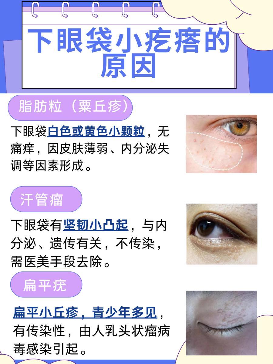 下眼袋有小疙瘩图片