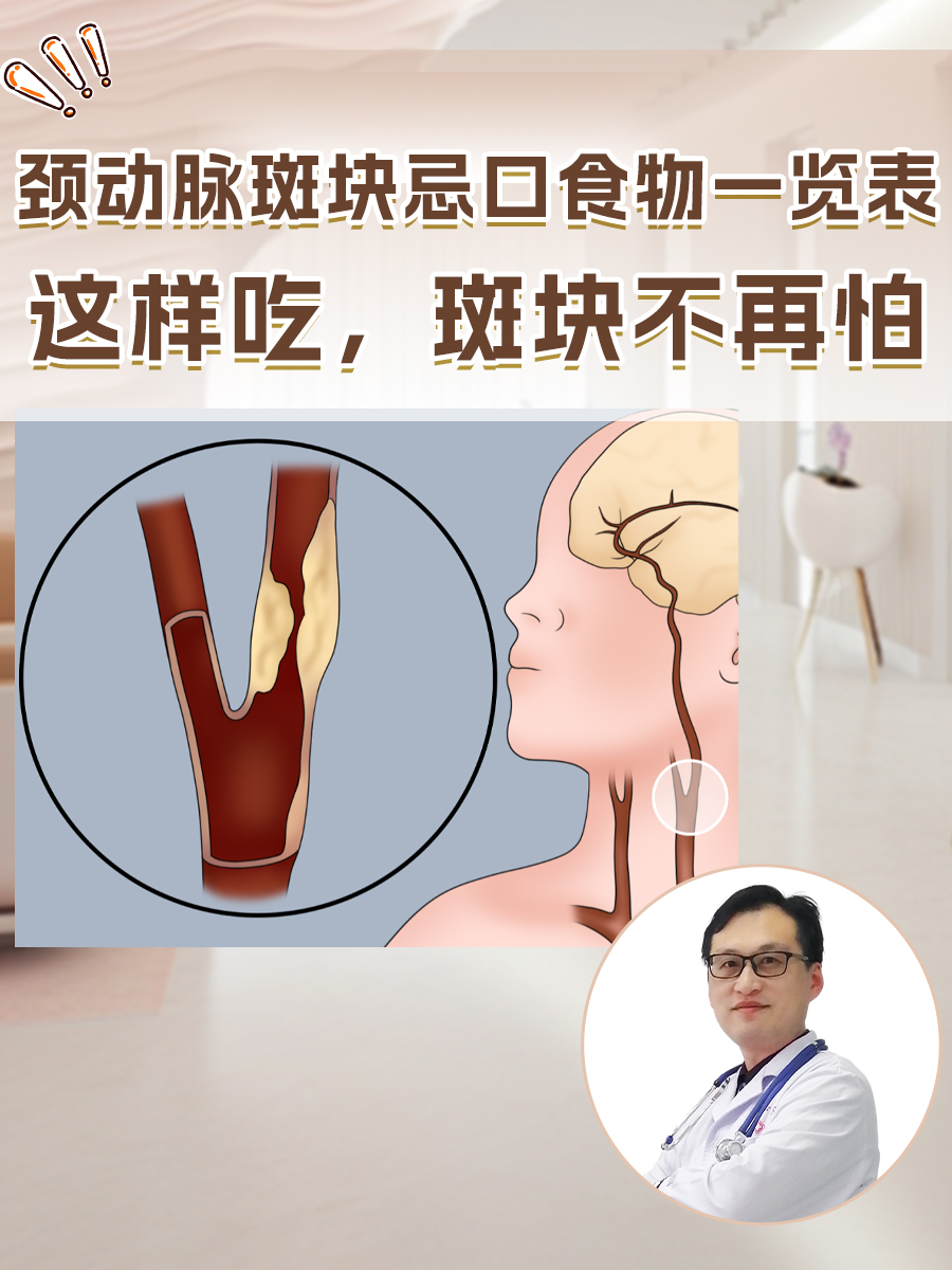 颈动脉斑块忌口食物一览表:这样吃,斑块不再怕