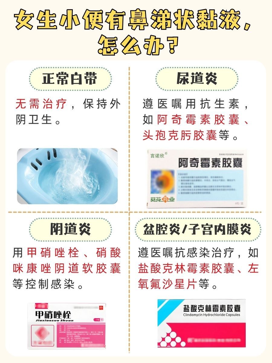 女生必看!小便有鼻涕状黏液,是身体在提示什么