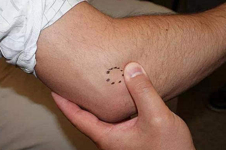 关节疼痛及压痛图 关节疼痛及压痛图