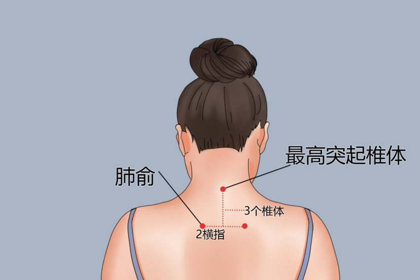 乳腺拔罐位置图片大全图片