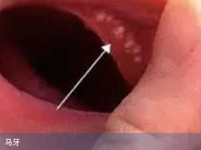 马牙