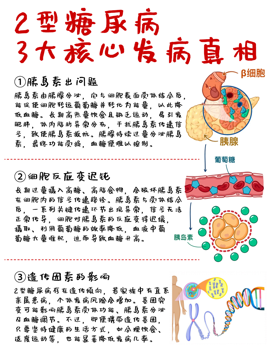 2型糖尿病为何“盯上”你？医生解惑
