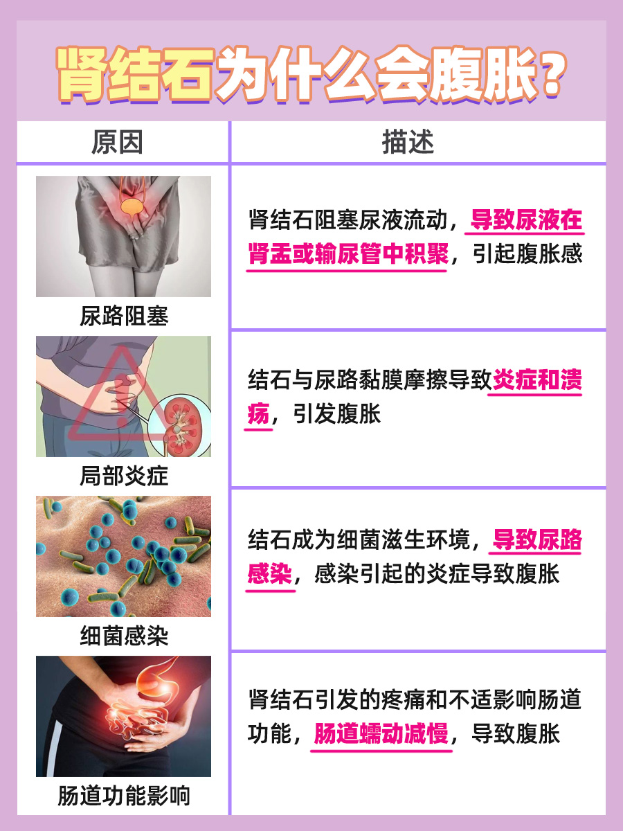 肾结石引发腹胀的神秘原因揭露