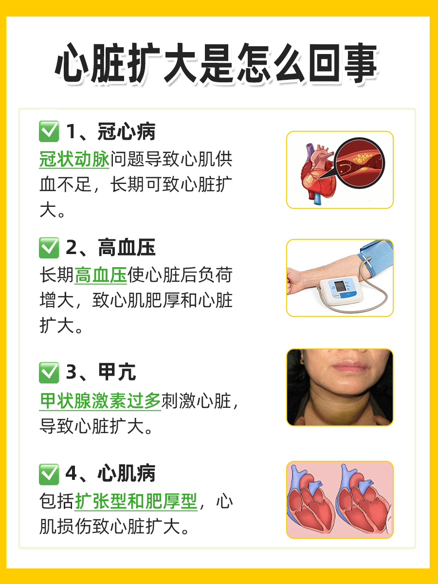 心脏扩大是怎么回事，严重吗？答案揭晓