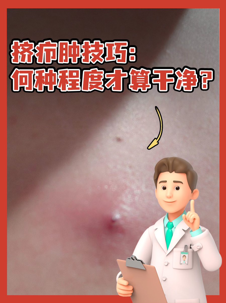 挤疖肿技巧:何种程度才算干净?