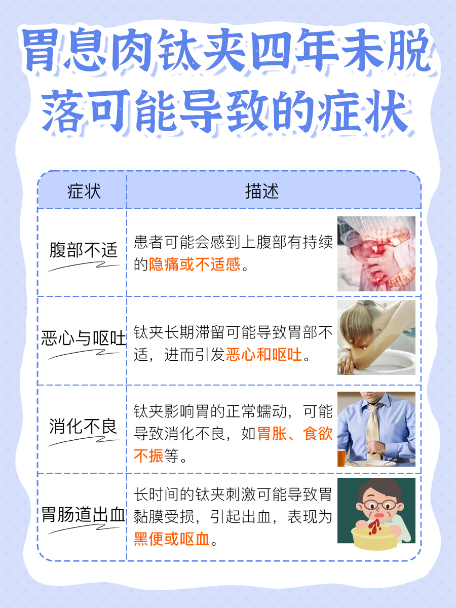 胃息肉钛夹四年没掉,这是怎么回事?