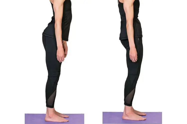 骨盆前倾和后倾图