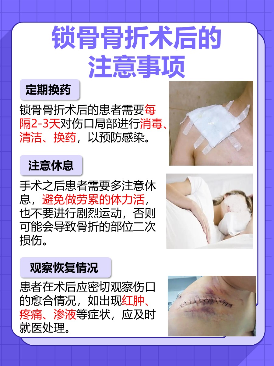 揭晓：锁骨骨折手术费用需要多少钱？