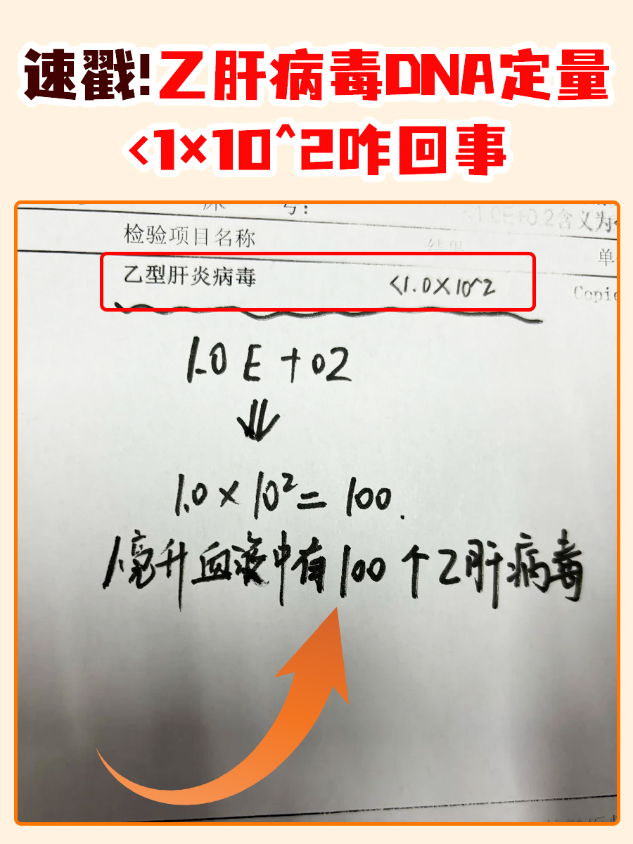 速戳！乙肝病毒DNA定量<1×10^2咋回事