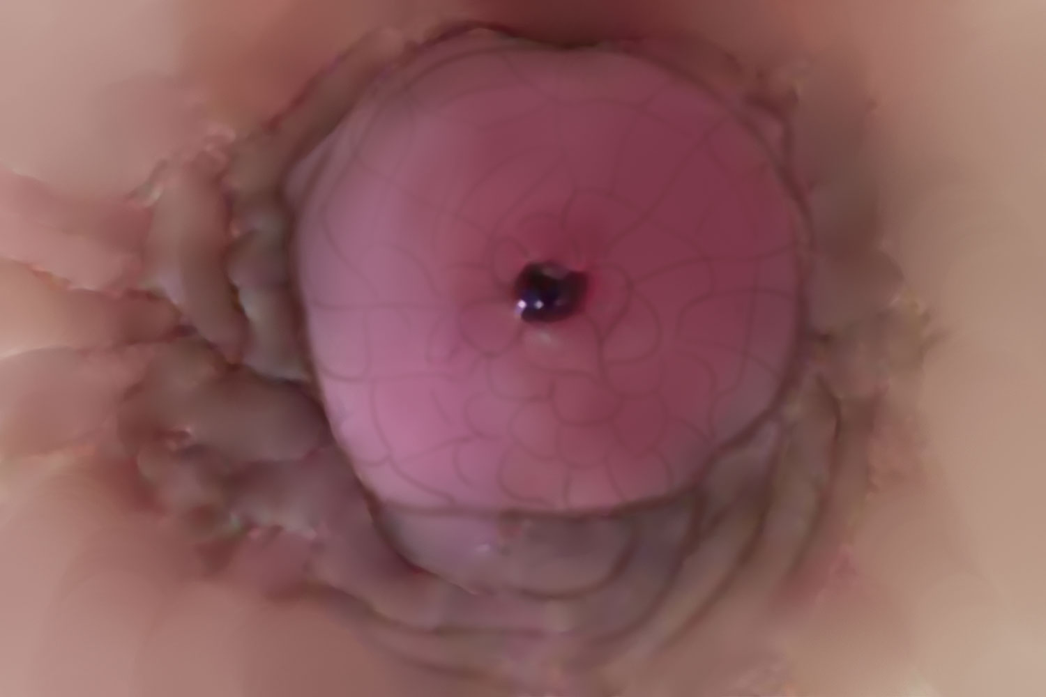 乳头乳晕改变图