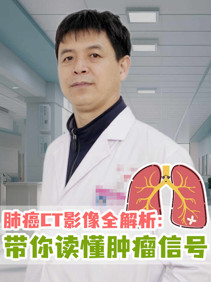 肺癌CT影像全解析：带你读懂肿瘤信号