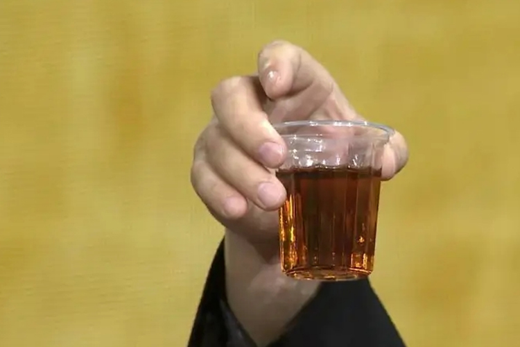 浓茶色尿液图 浓茶色尿液图