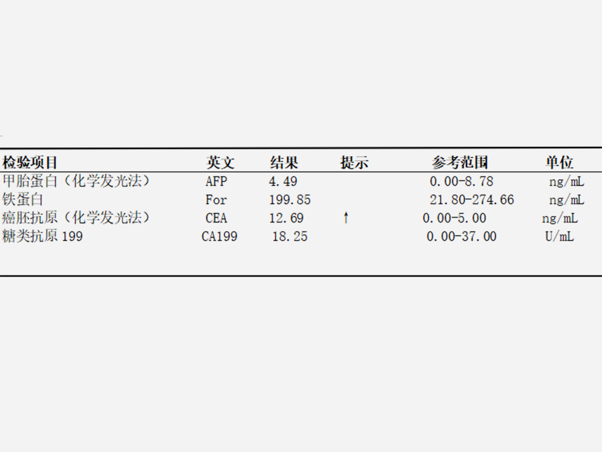 肺鳞癌（老大爷确诊肺鳞癌，手术治疗联合靶向治疗为其助力）.jpg