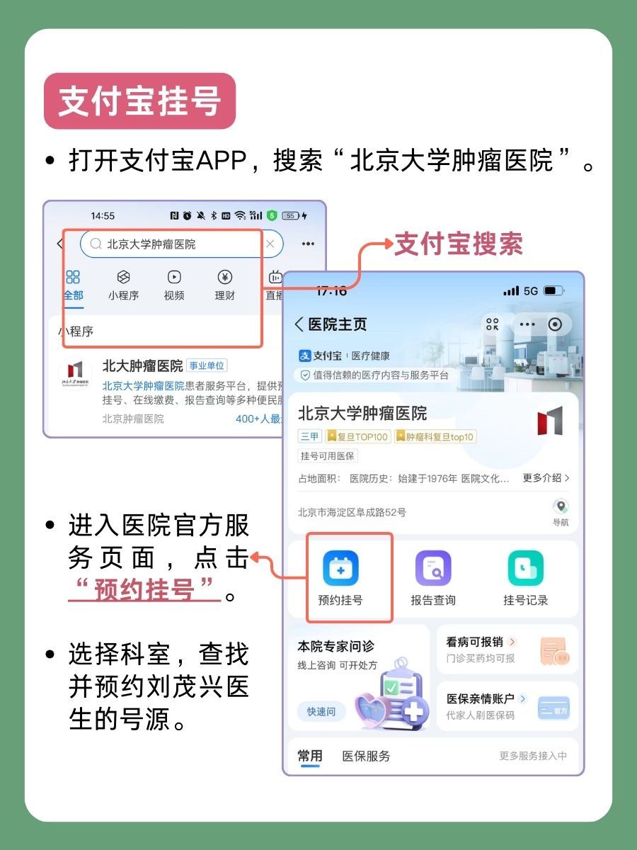 北京大学肿瘤医院刘茂兴医生怎么样?怎么挂号?