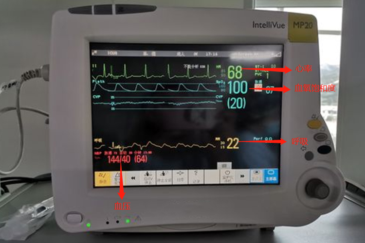 生命体征监护仪参数图