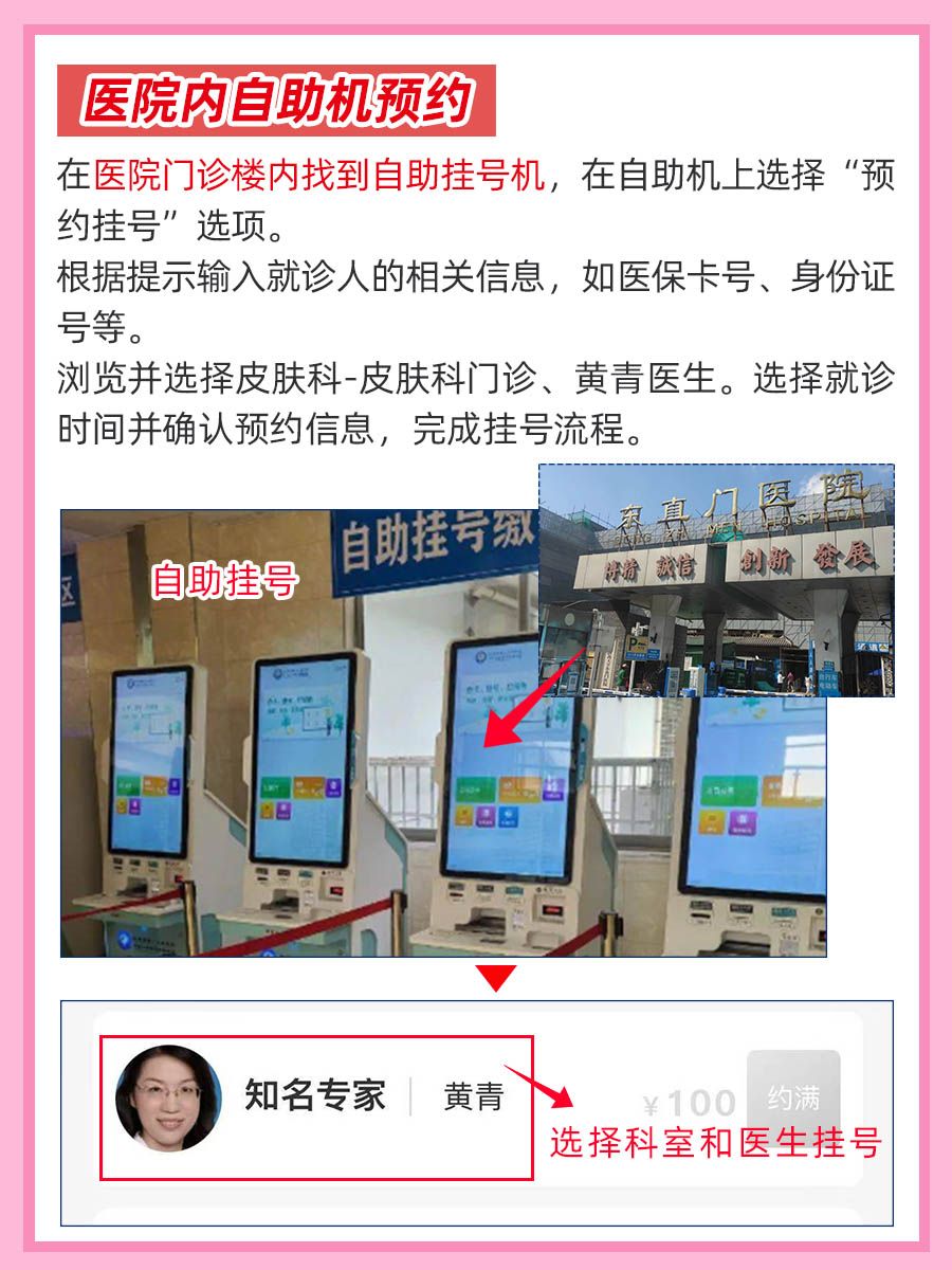 北京东直门医院黄青医生怎么样？怎么挂号？