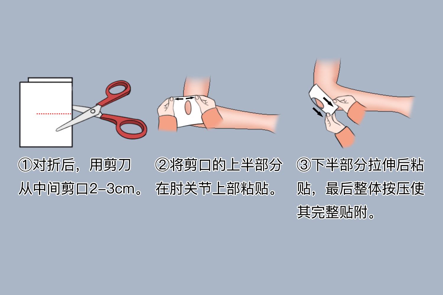 氟比洛芬凝胶贴膏贴附肘关节图