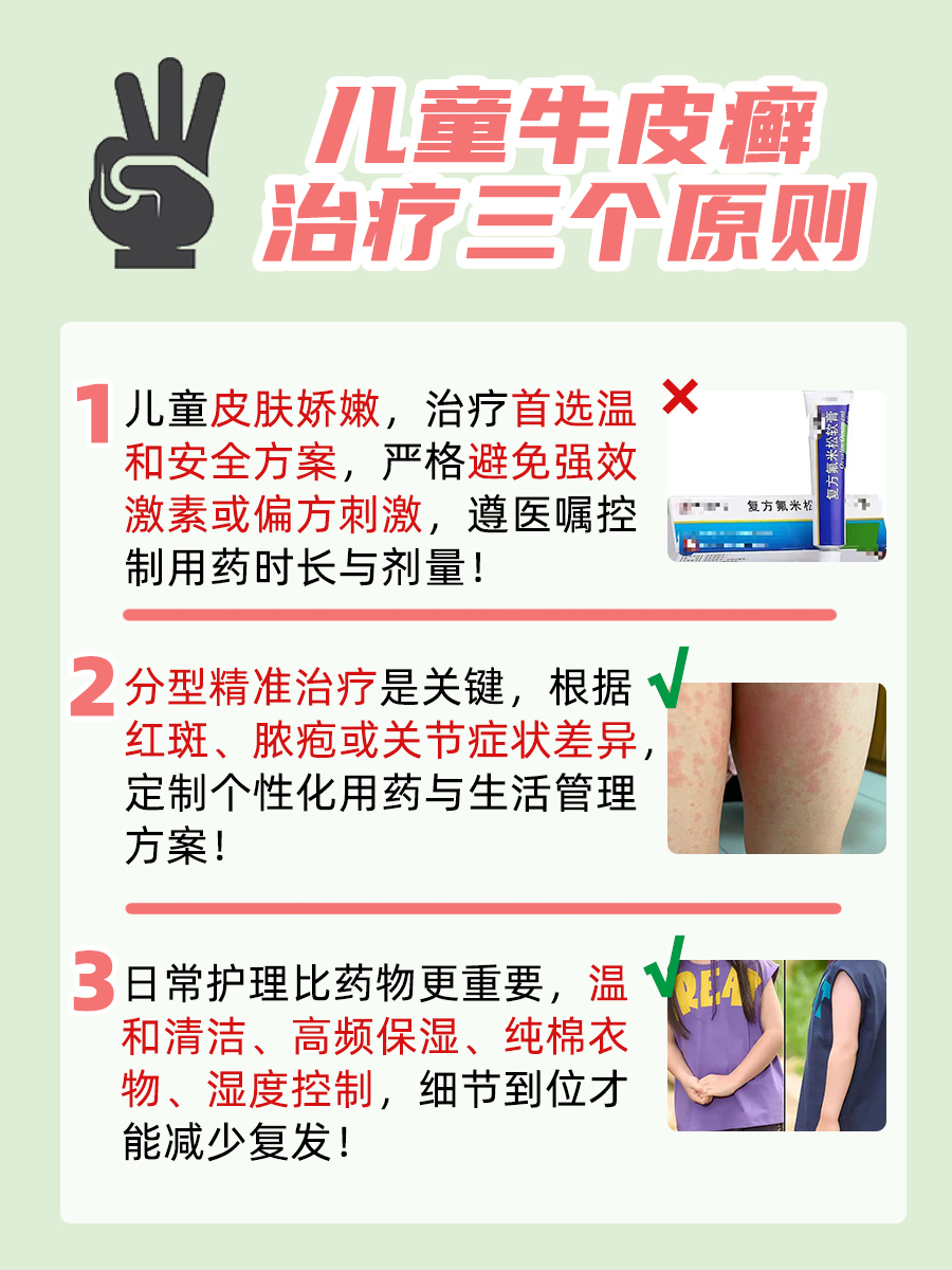 儿童牛皮癣最好治疗方法,少走弯路不踩坑!