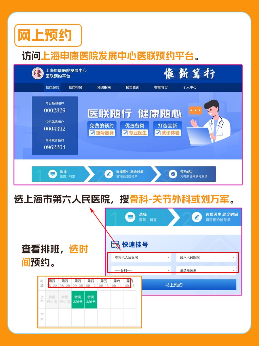 上海市第六人民医院刘万军医生怎么样？怎么挂号？
