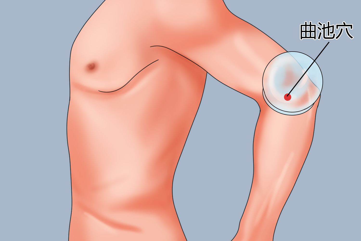 曲池穴拔罐图 曲池穴拔罐图