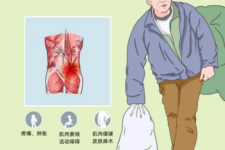 筋膜炎的6大表现症状图