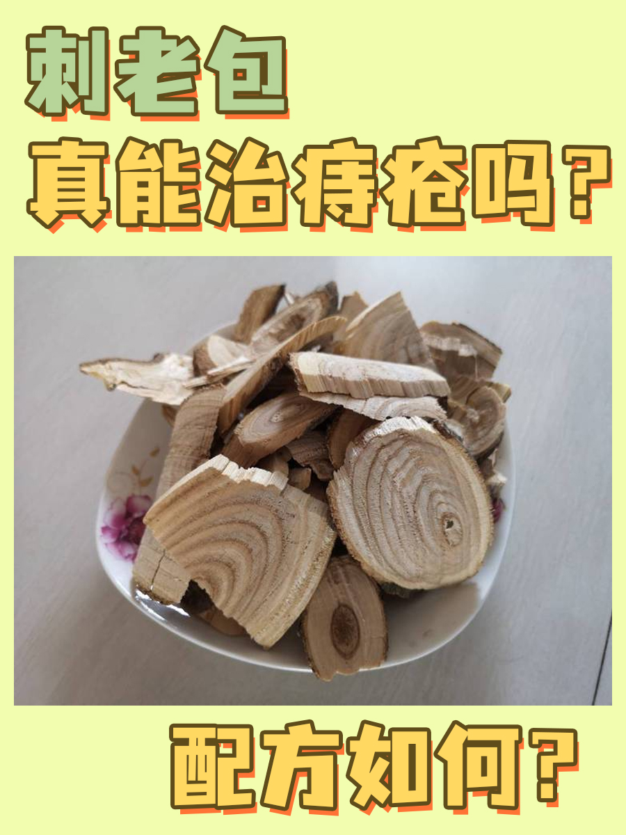 刺老包真能治痔疮吗？配方如何？