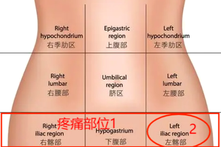溃疡性结肠炎疼痛部位图