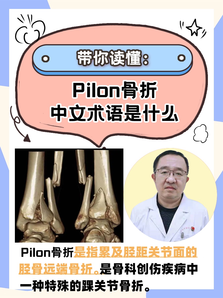 带你读懂：Pilon骨折中文术语是什么