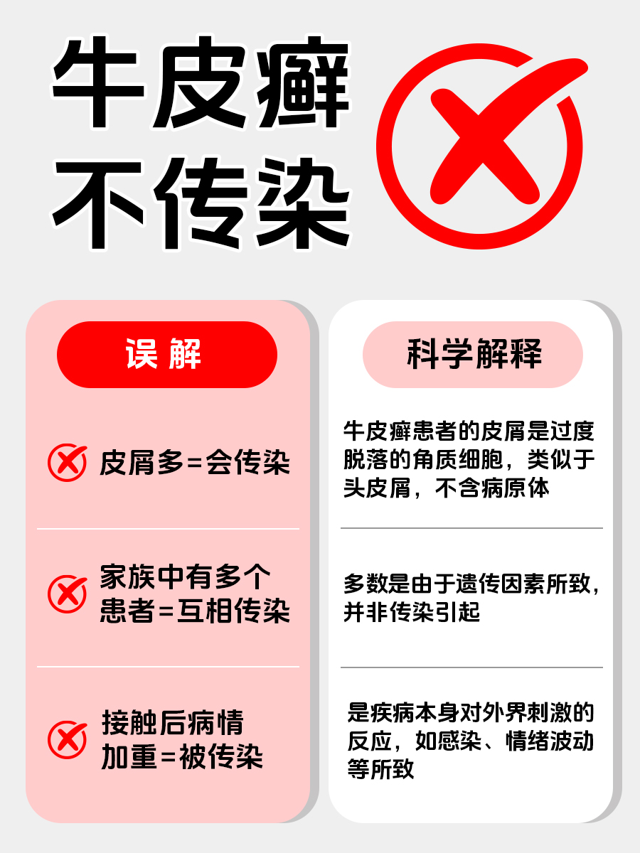 接触牛皮癣会传染吗？彻底打破你的顾虑！
