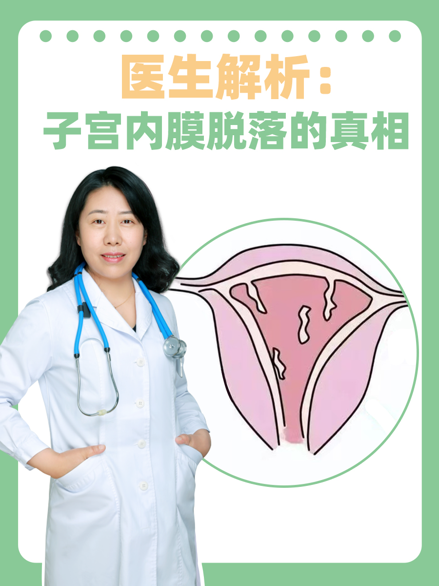 医生解析：子宫内膜脱落的真相