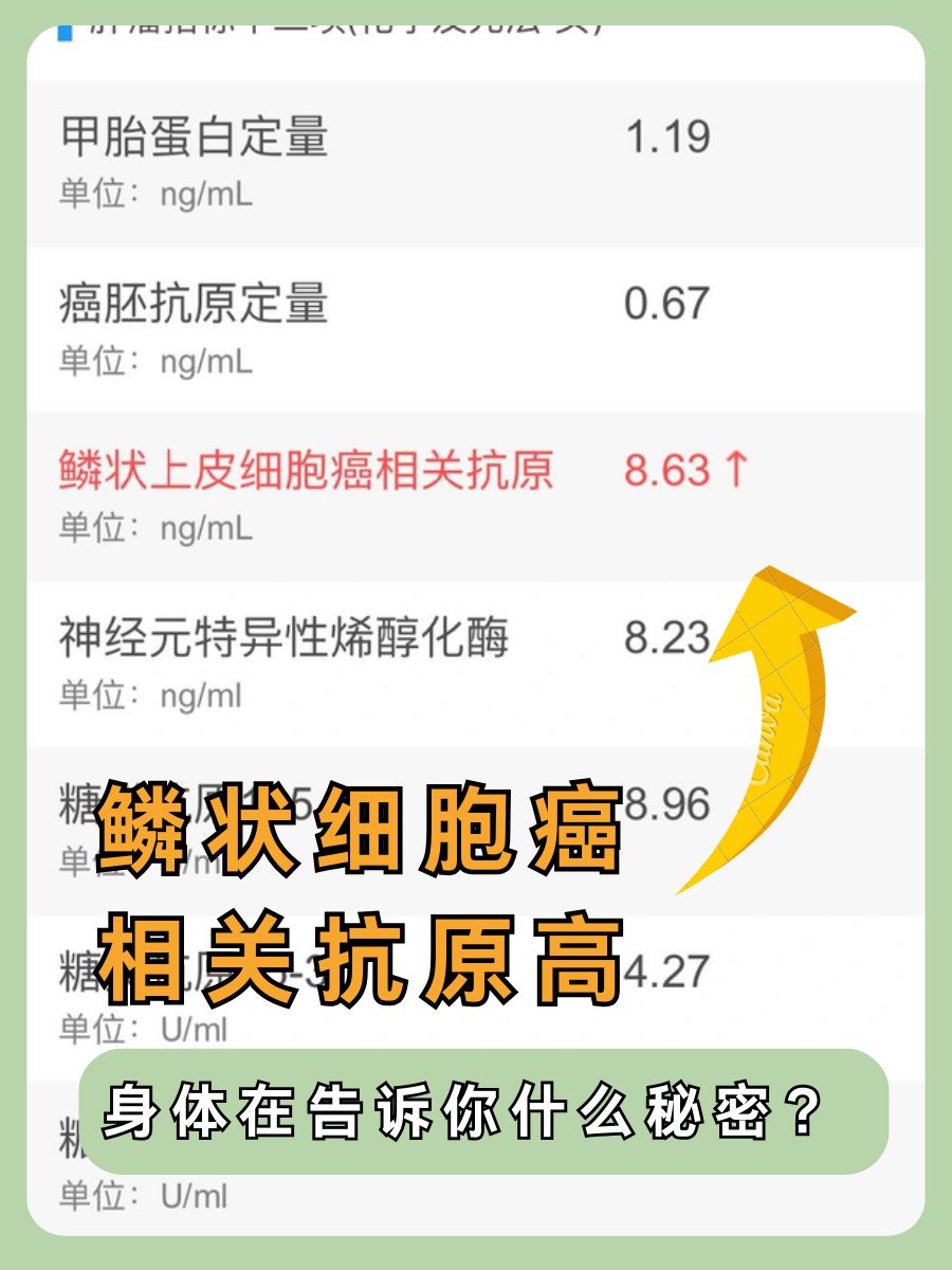 鳞状细胞癌相关抗原高，身体在告诉你什么秘密？