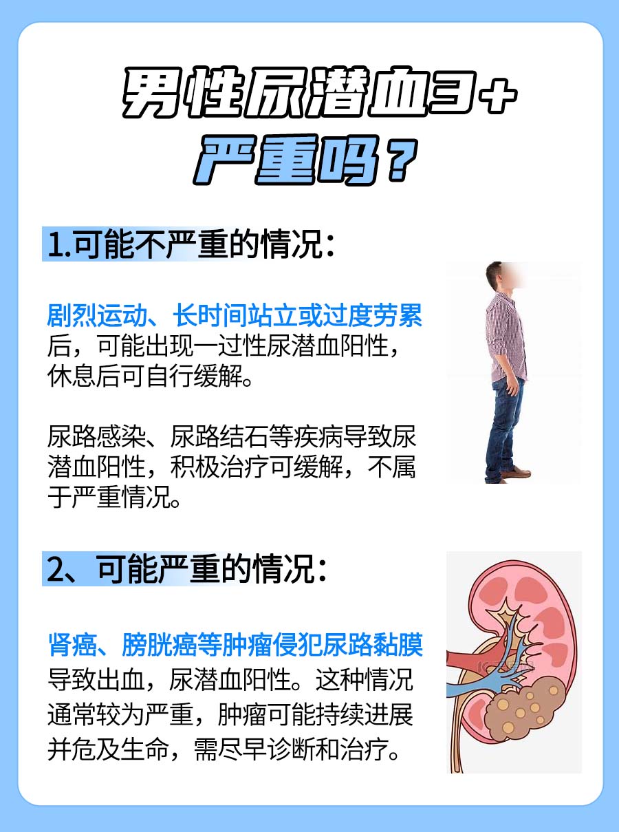 男性尿潜血3+：解读其严重与否