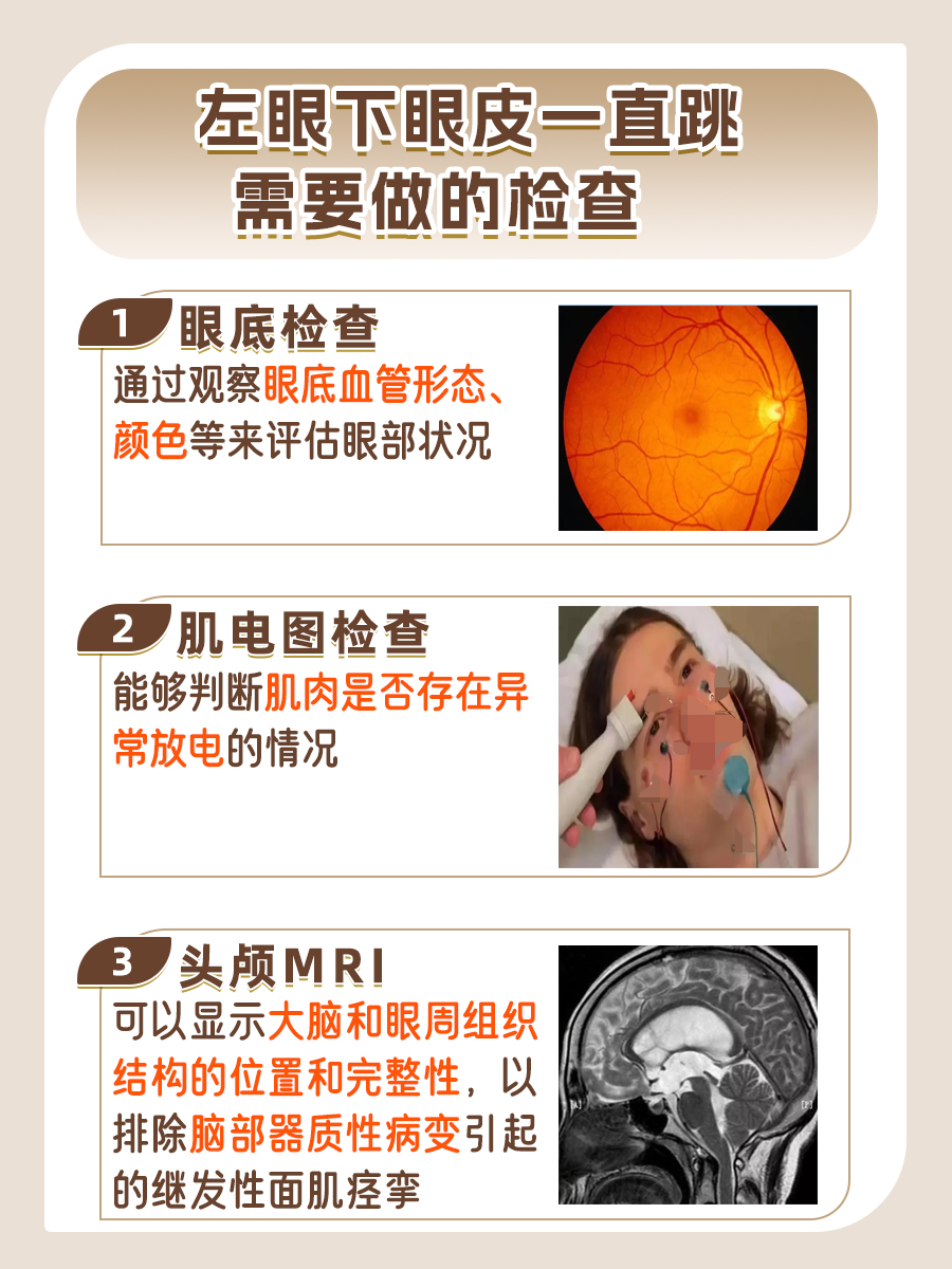 左眼下眼皮一直跳有什么预兆?了解这些原因!