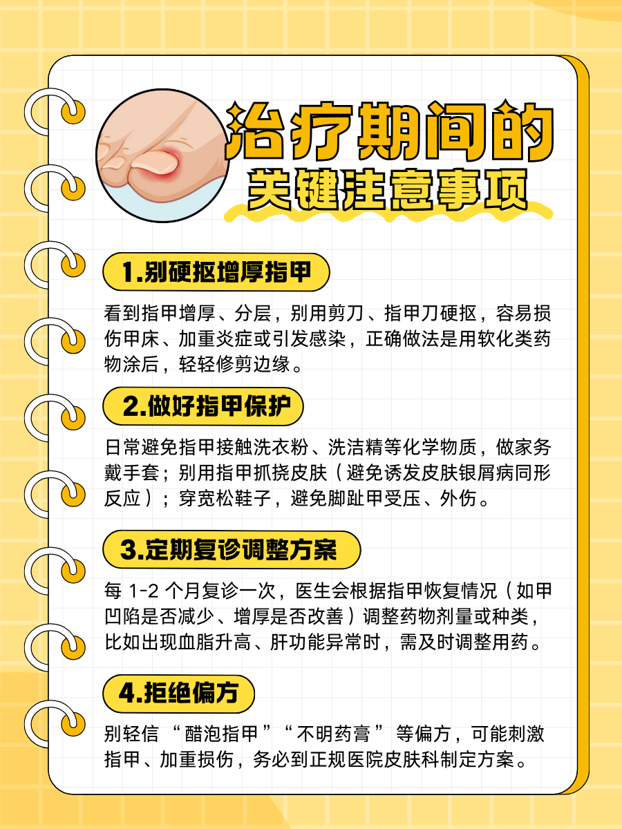 银屑病甲怎么治疗，医生来支招！