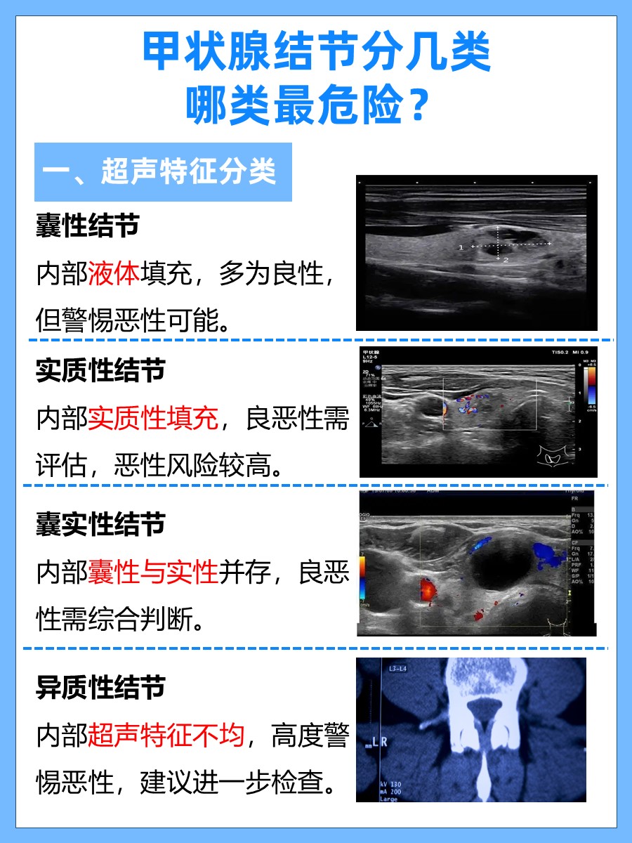 甲状腺结节分几类，哪类最危险？你了解多少？