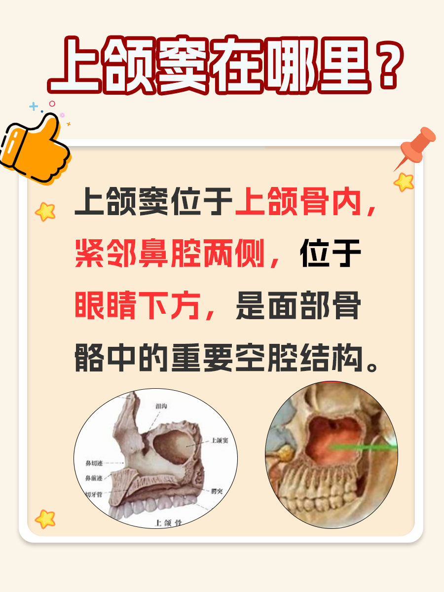 面部骨骼中的秘密：上颌窦的位置揭秘
