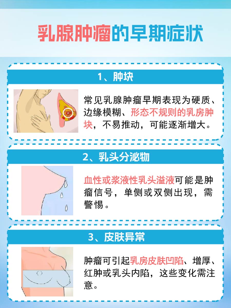 警惕!这些信号可能是乳腺肿瘤的早期迹象